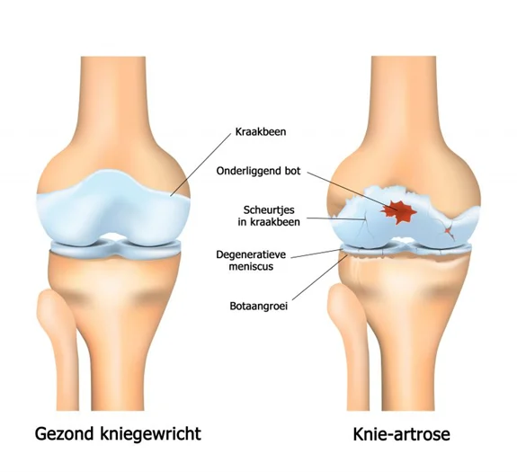 kniegewricht