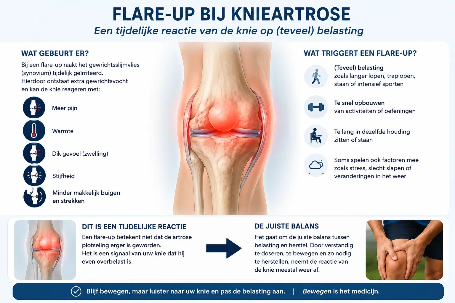Afbeelding flare up