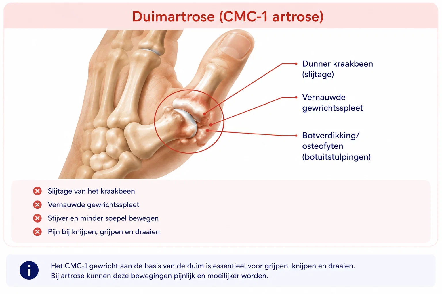 260901 Duimartrose